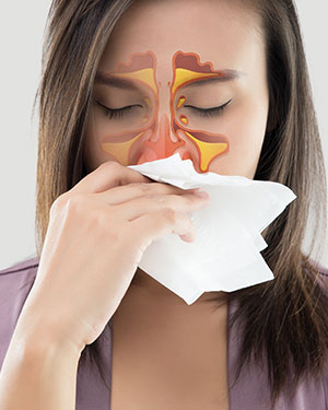 Congested Sinus Near Me in San Francisco, CA