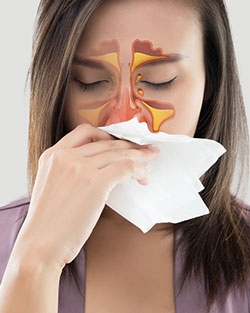 Congested Sinus Near Me in San Francisco, CA