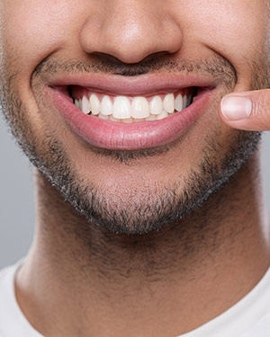 Fix Grinding and Gum Recession Near Me in San Francisco, CA