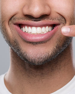 Fix Grinding and Gum Recession Near Me in San Francisco, CA
