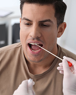 Oral Microbiome Testing Near Me in San Francisco, CA