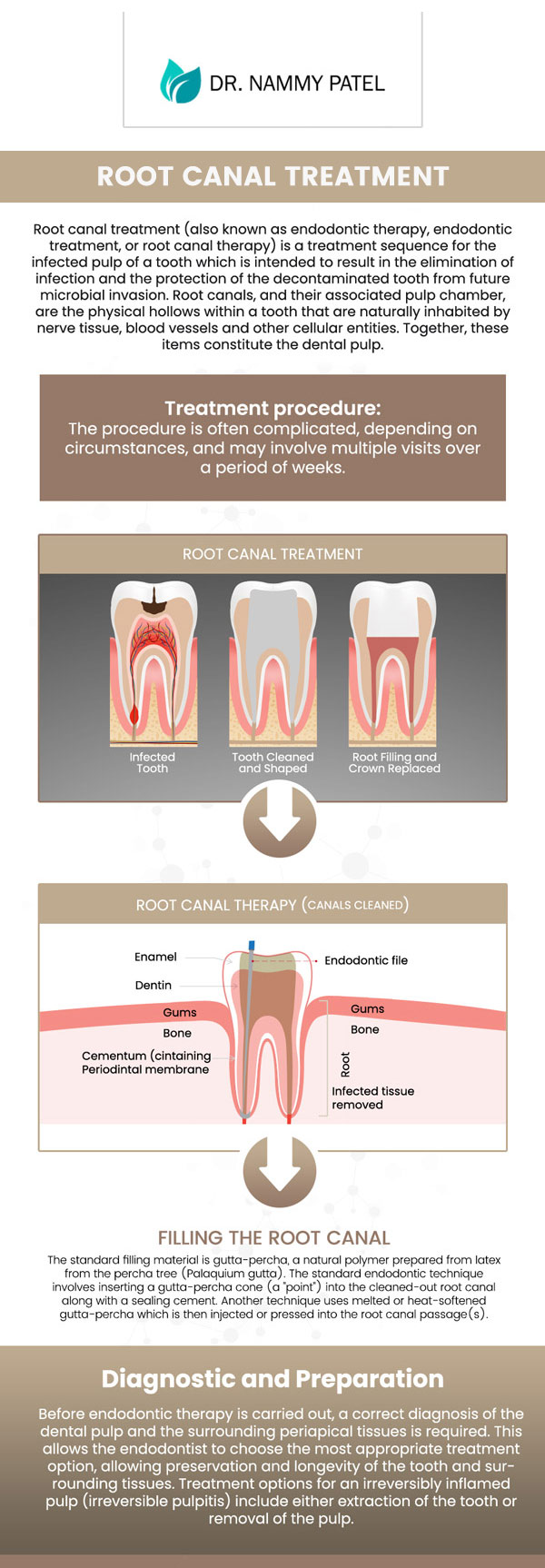 Common questions asked by patients: What is a root canal, and when is it necessary? What are the signs that I might need a root canal? How does a root canal save a tooth from extraction? What should I expect during a root canal procedure? For more information, please contact us or schedule an appointment online. We are conveniently located at 360 Post St Ste 704 San Francisco, CA 94108. We serve patients from San Francisco CA, Emeryville CA, Sausalito CA, Oakland CA, Berkeley CA, and surrounding areas. Common questions asked by patients: What is a root canal, and when is it necessary? What are the signs that I might need a root canal? How does a root canal save a tooth from extraction? What should I expect during a root canal procedure? For more information, please contact us or schedule an appointment online. We are conveniently located at 360 Post St Ste 704 San Francisco, CA 94108. We serve patients from San Francisco CA, Emeryville CA, Sausalito CA, Oakland CA, Berkeley CA, and surrounding areas.