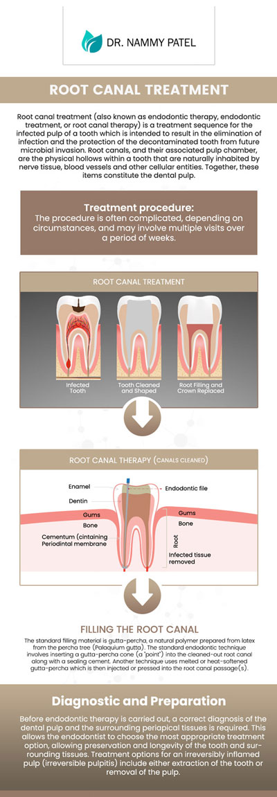 Common questions asked by patients: What is a root canal, and when is it necessary? What are the signs that I might need a root canal? How does a root canal save a tooth from extraction? What should I expect during a root canal procedure? For more information, please contact us or schedule an appointment online. We are conveniently located at 360 Post St Ste 704 San Francisco, CA 94108. We serve patients from San Francisco CA, Emeryville CA, Sausalito CA, Oakland CA, Berkeley CA, and surrounding areas. Common questions asked by patients: What is a root canal, and when is it necessary? What are the signs that I might need a root canal? How does a root canal save a tooth from extraction? What should I expect during a root canal procedure? For more information, please contact us or schedule an appointment online. We are conveniently located at 360 Post St Ste 704 San Francisco, CA 94108. We serve patients from San Francisco CA, Emeryville CA, Sausalito CA, Oakland CA, Berkeley CA, and surrounding areas.